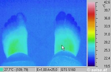 des pieds - (Infrarouge pictures / thermography of a foot